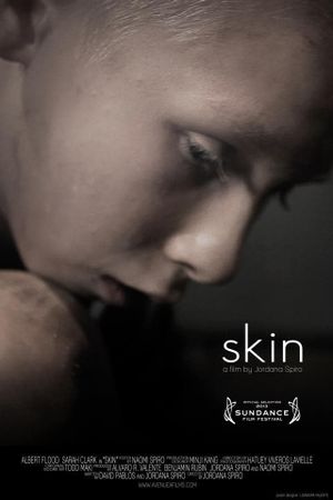 Skin's poster