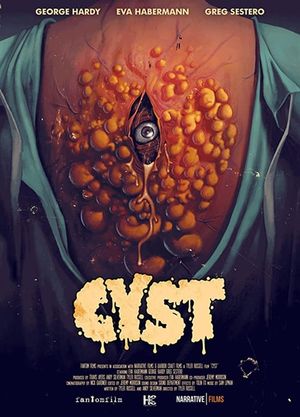 Cyst's poster