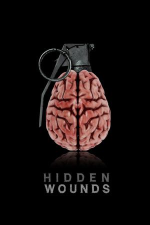 Hidden Wounds's poster