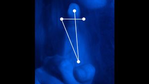 Blue Light Blue's poster