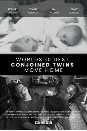 World's Oldest Conjoined Twins Move Home's poster
