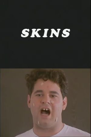 Skins's poster
