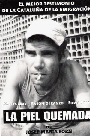 Burnt Skin's poster