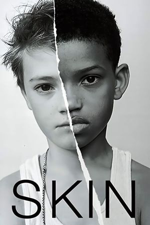 Skin's poster