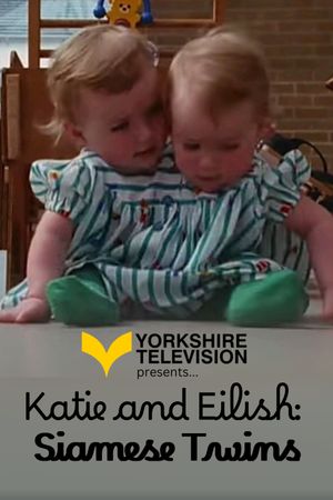 Katie and Eilish: Siamese Twins's poster