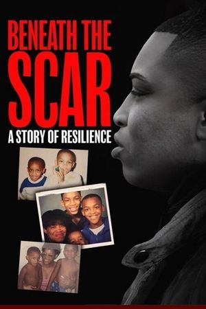 Beneath the Scar: A Story of Resilience's poster