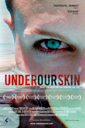 Under Our Skin's poster