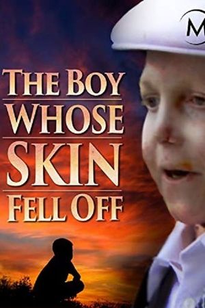 The Boy Whose Skin Fell Off's poster