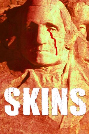 Skins's poster