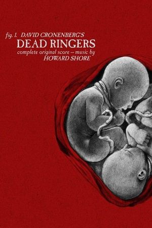Dead Ringers's poster