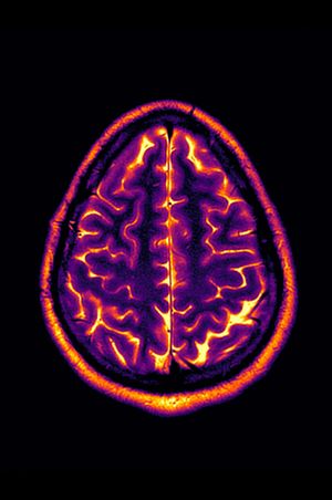 Conclusion: Stable Disease's poster