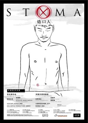 Stoma's poster