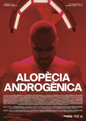 Androgenic Alopecia's poster