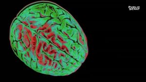 Le pouvoir nuit-il gravement au cerveau ?'s poster
