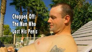 Chopped Off: The Man Who Lost His Penis's poster