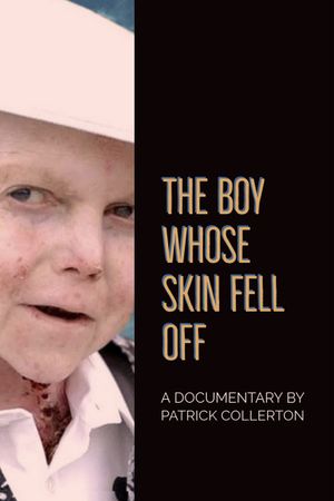The Boy Whose Skin Fell Off's poster