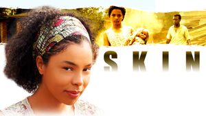 Skin's poster