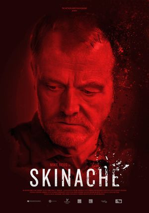 Skinache's poster