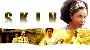 Skin's poster
