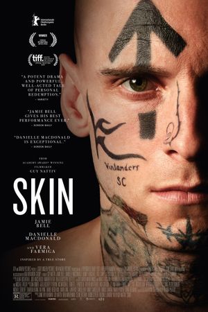 Skin's poster