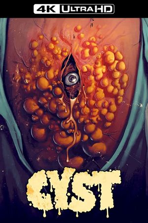 Cyst's poster