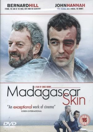 Madagascar Skin's poster
