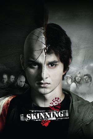 Skinning's poster