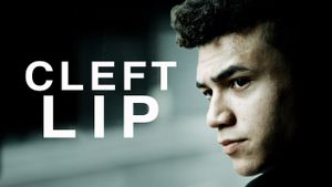 Cleft Lip's poster