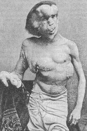 Joseph Merrick: The Real Elephant Man's poster