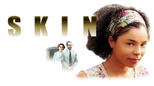 Skin's poster