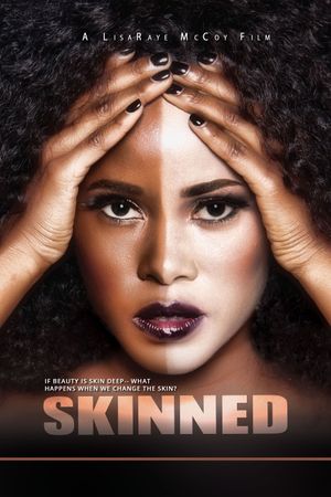 Skinned's poster