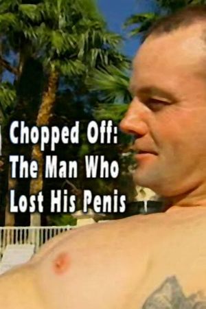 Chopped Off: The Man Who Lost His Penis's poster image