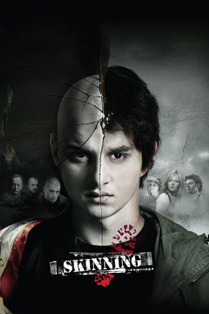 Skinning's poster