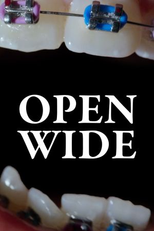 Open Wide's poster