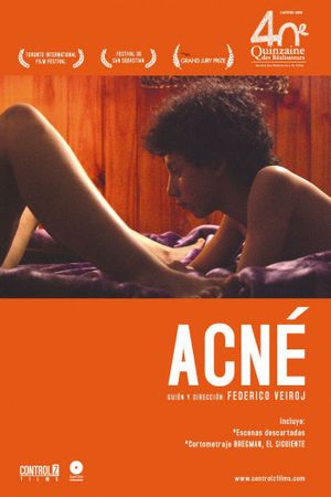 Acne's poster