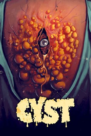 Cyst's poster