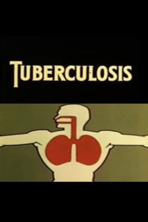 Health for the Americas: Tuberculosis's poster