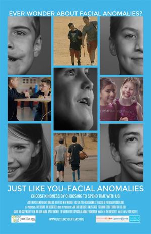 Just Like You: Facial Anomalies's poster