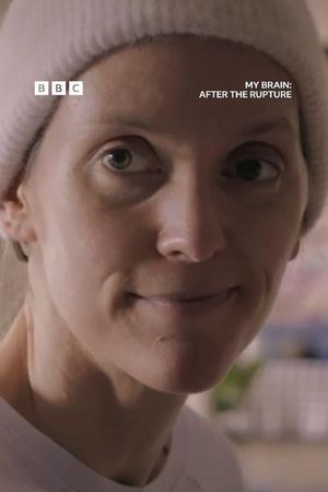 My Brain: After the Rupture's poster