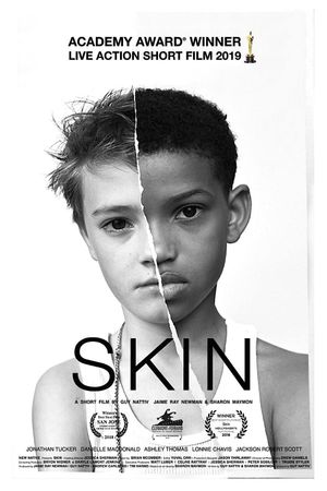 Skin's poster