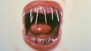 The Dentist 2's poster