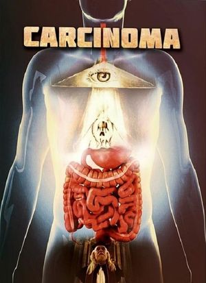 Carcinoma's poster