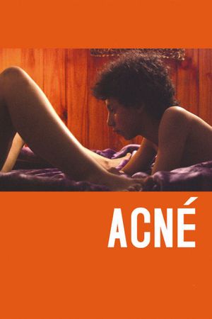 Acne's poster