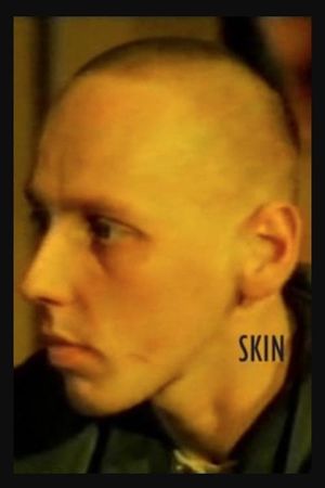 Skin's poster