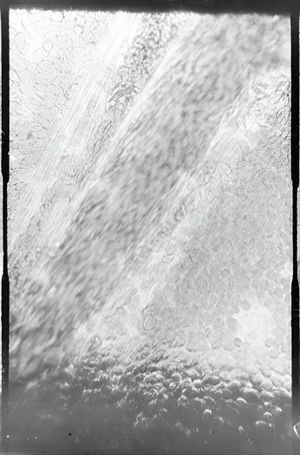 Déplacement des globules de sang dans un vaisseau capillaire's poster