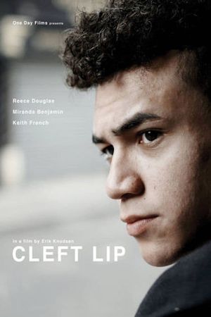 Cleft Lip's poster