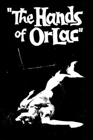 The Hands of Orlac's poster