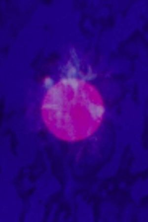 LSD's poster
