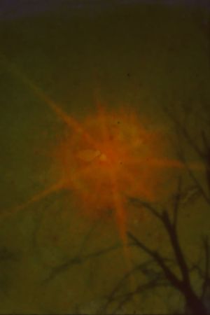 Sun Song's poster