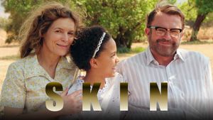 Skin's poster